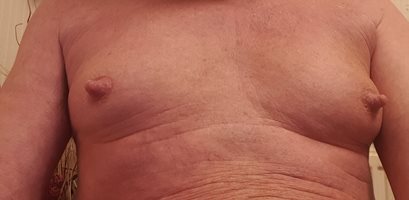 Erect nipples