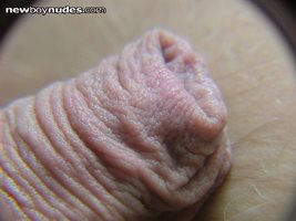 my foreskin under a magnifying glass
