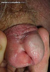 the hole in my male clit needs scratching