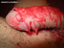 hot wax on my cock and balls