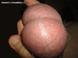my balls