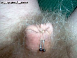 Foreskin pinned shut to keep the head in