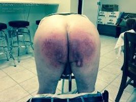 Another picture of my latest spanking